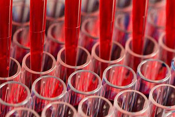 отбор материала в лаборатории