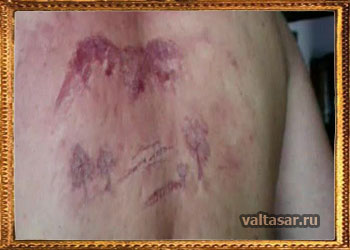 последствия контакта с шаровой молнией