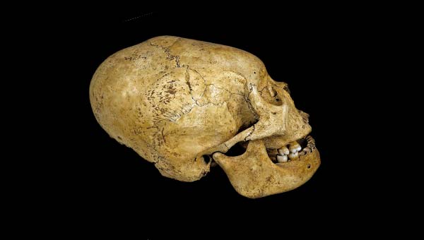 деформированный череп