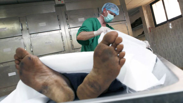 санитар и труп в морге