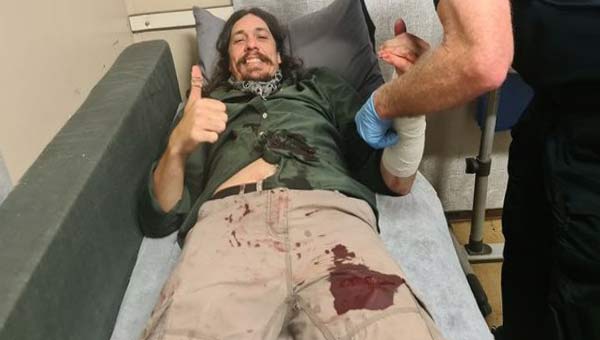 ловец змей в больнице