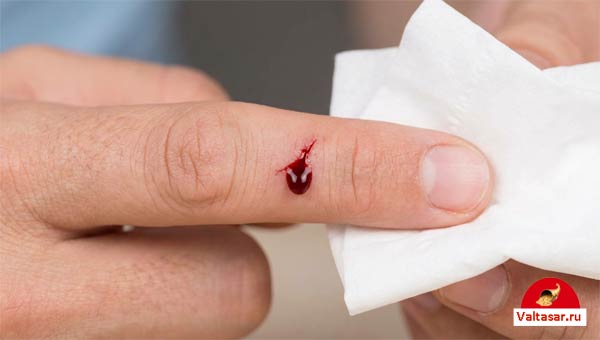 кровь идет из порезанного пальца
