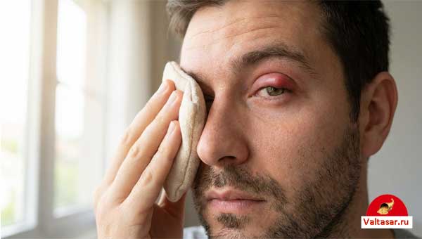 мужчина с ячменем на глазу