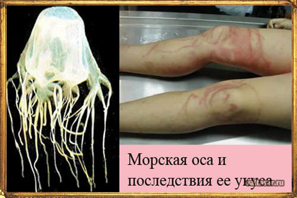медуза морская оса